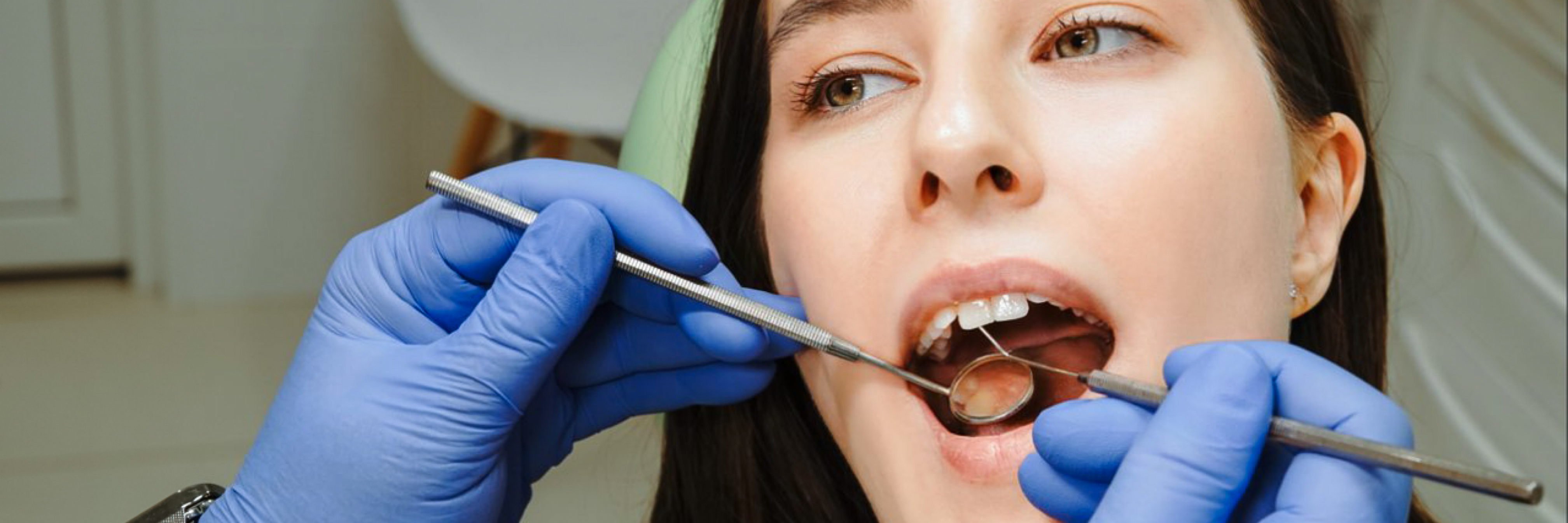 Киста зуба: лечение, симптомы и причины возникновения